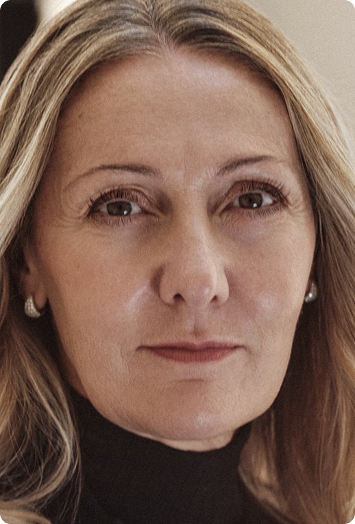 Skin Quality: Tono della pelle