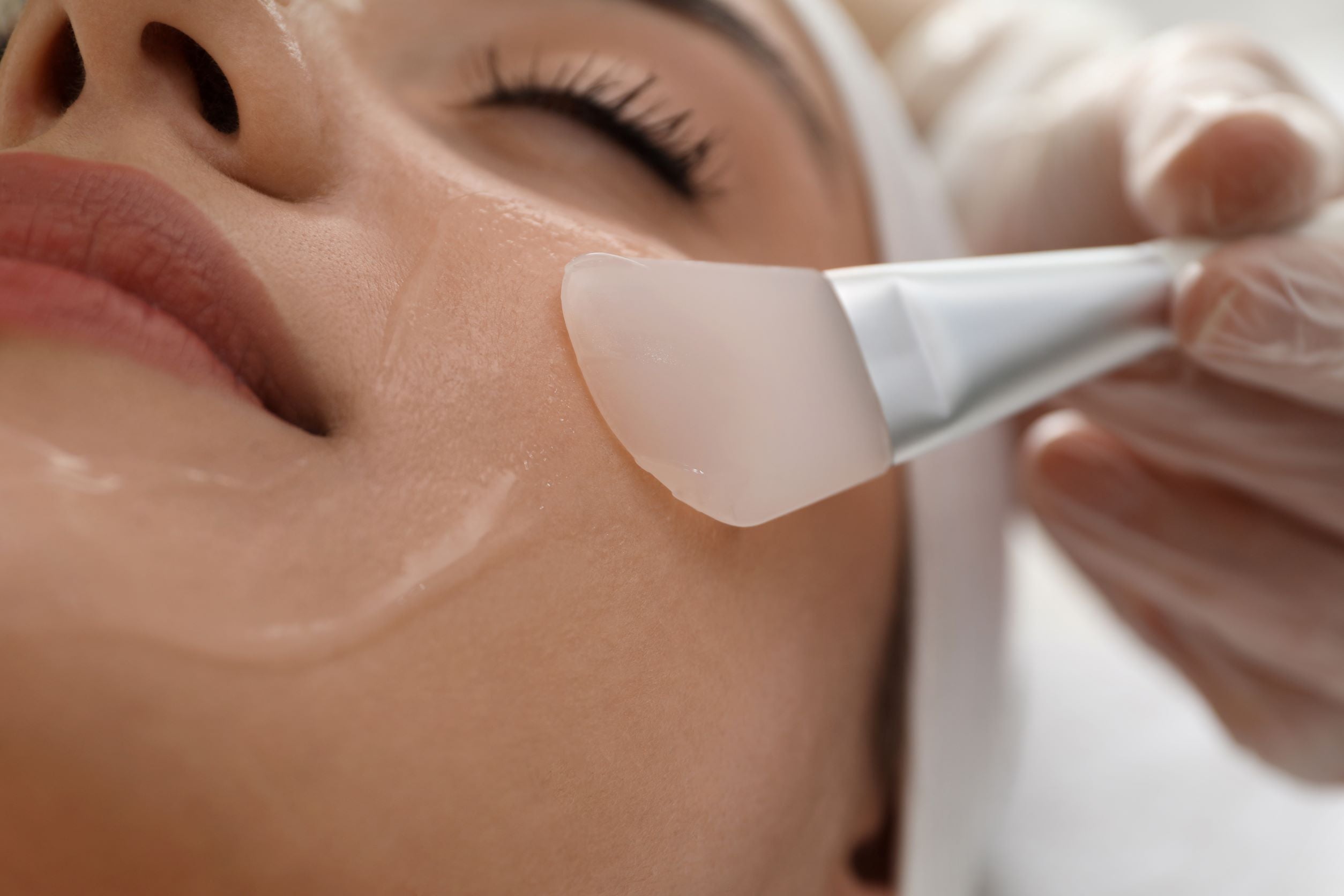 Scopri di più sui peeling chimici