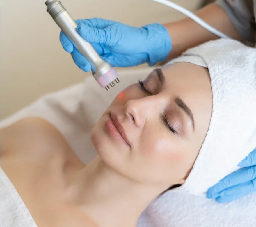 Radiofrequenza per il viso: a cosa serve e quali benefici apporta alla pelle