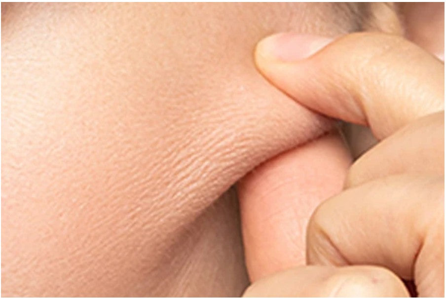 Come mantenere la pelle più elastica nel tempo: cause e rimedi