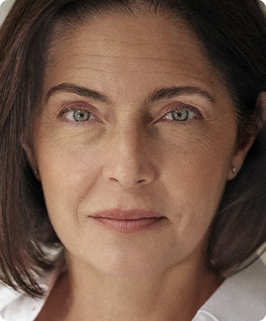 Skin Quality: densità della pelle