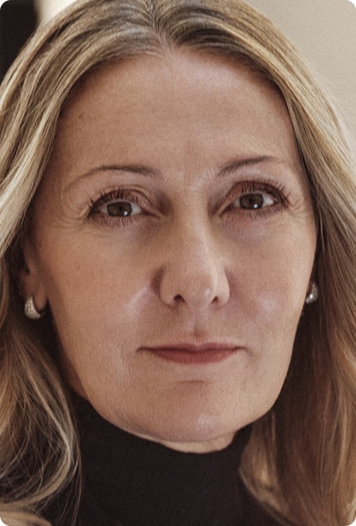 Skin Quality: Tono della pelle