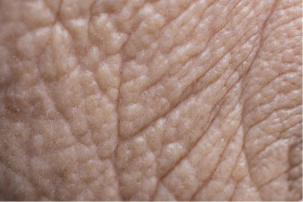 Inflamm'aging: comprendere come l'infiammazione contribuisce all'invecchiamento cutaneo