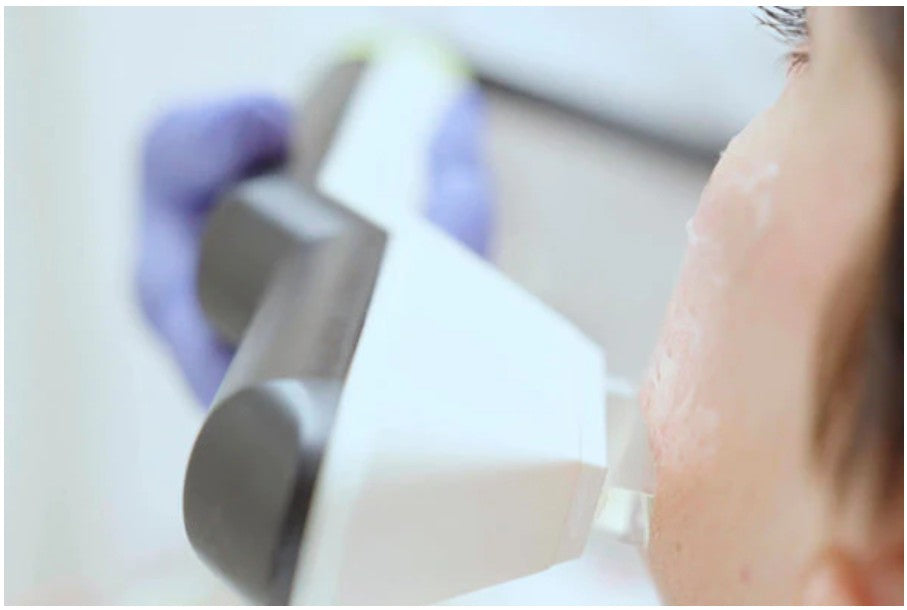 Laser per il viso nella medicina estetica: quali sono i benefici?