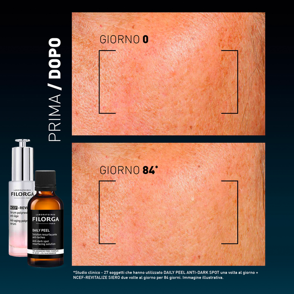 DAILY PEEL ANTI-DARK SPOT 50ML